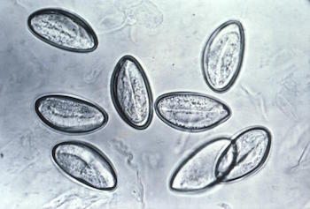 pinworm-eggs-wikipedia.jpeg